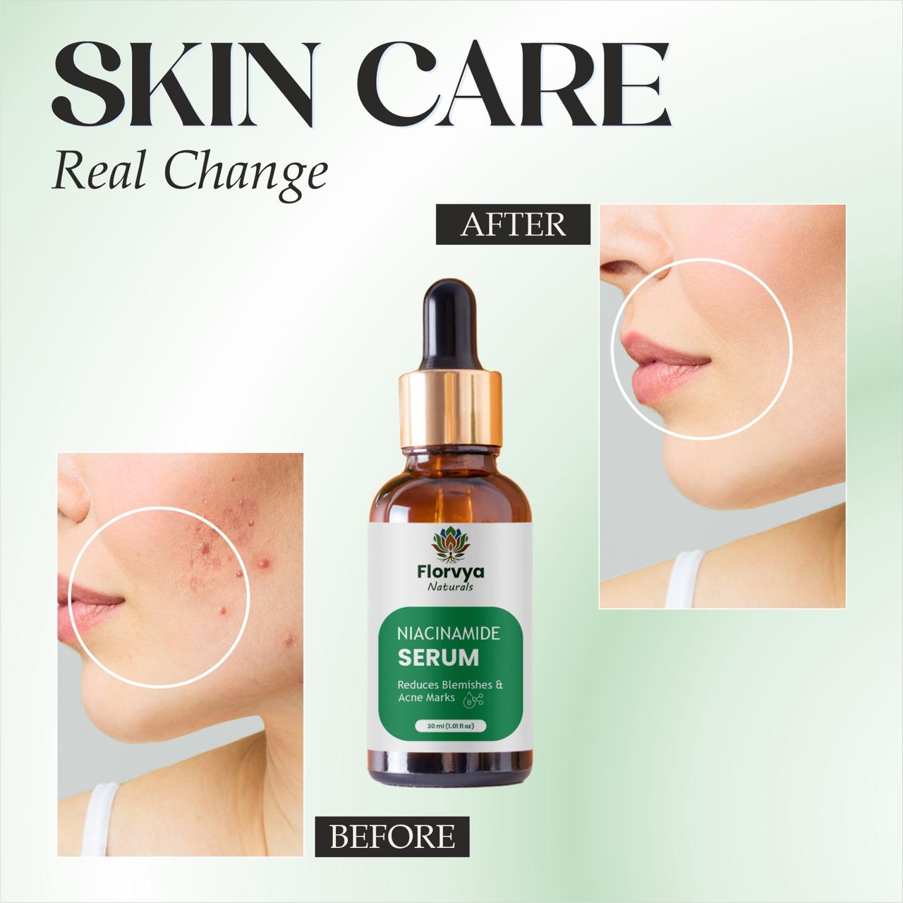 Niacinamide Serum: Product Visuals