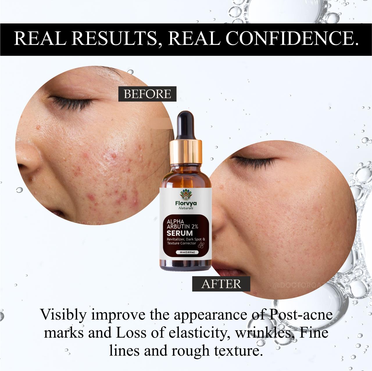 Precision & Quality: Alpha Arbutin Serum Dropper